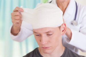 Can Head Injury Cause Stroke