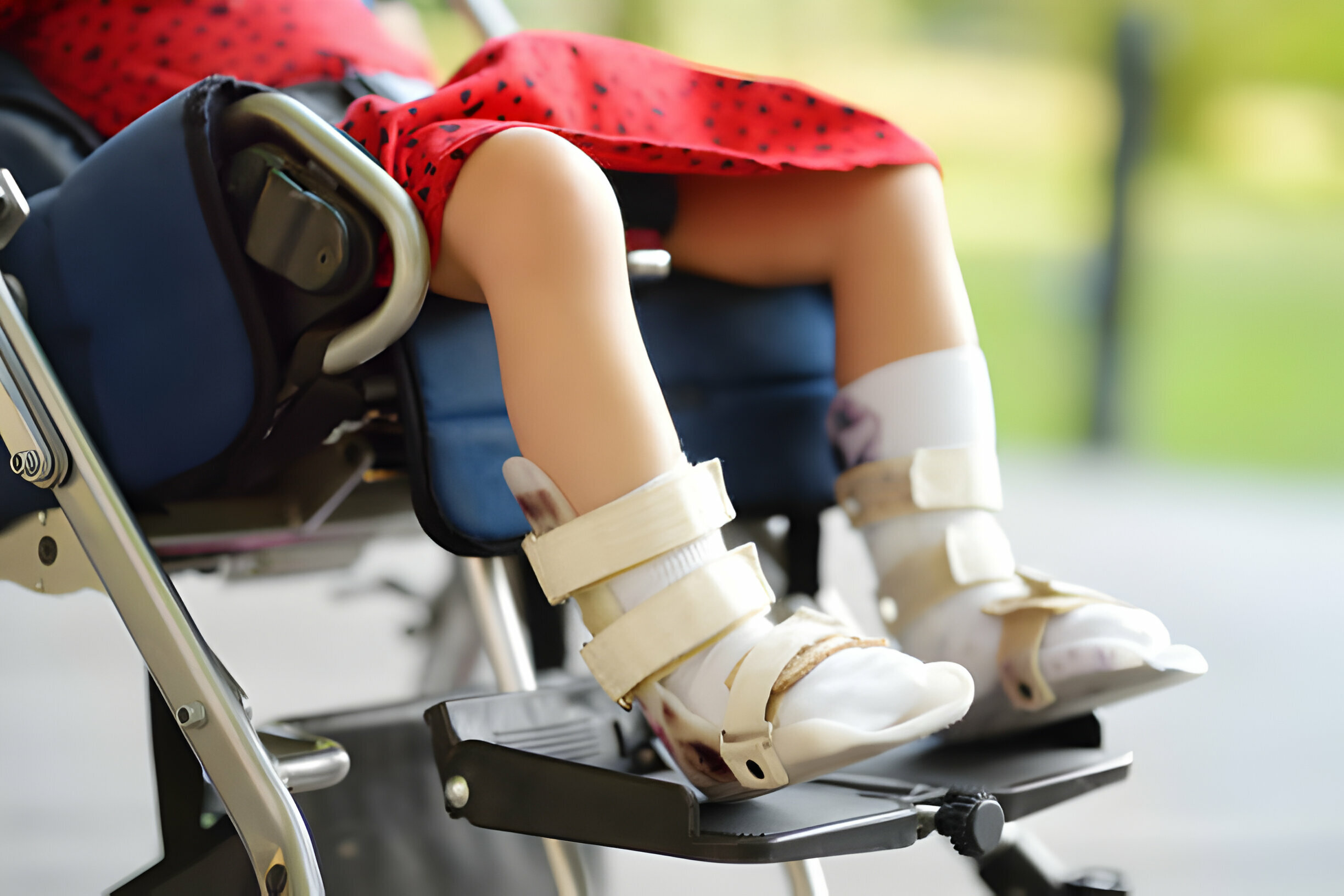 Can Genes Cause Cerebral Palsy?