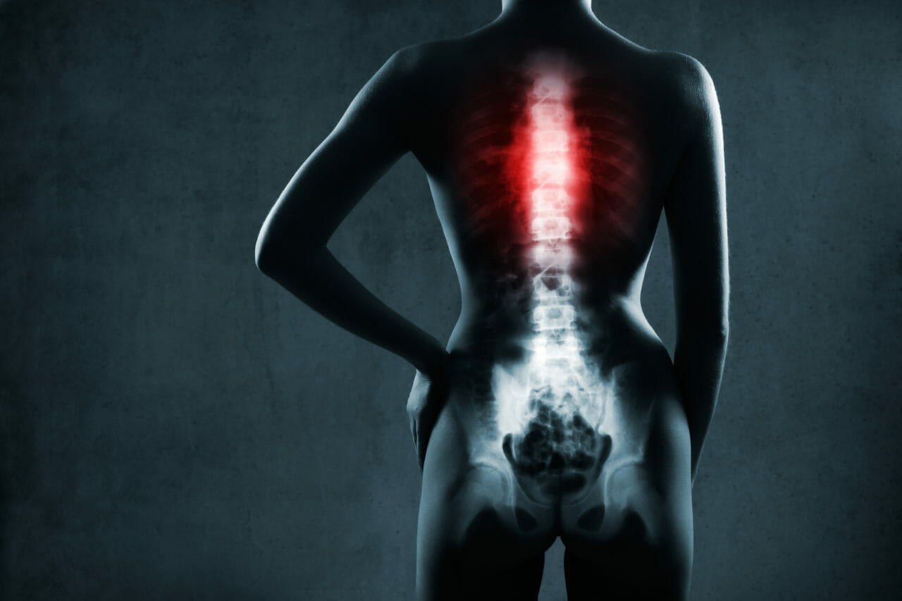 what is T4 spinal cord injury