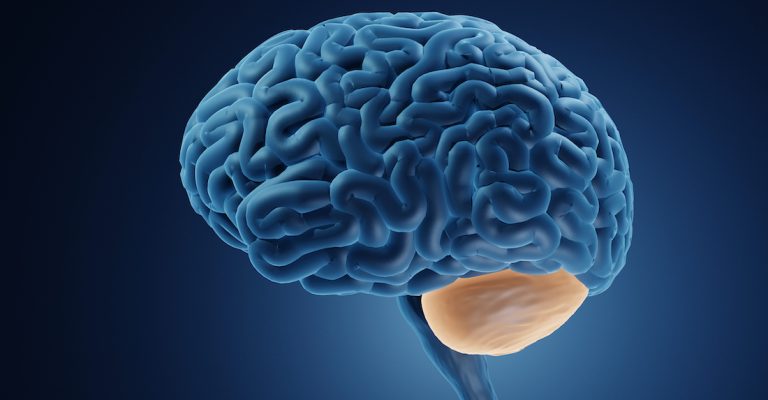 Cerebellum Brain Damage Causes Effects And Rehabilitation