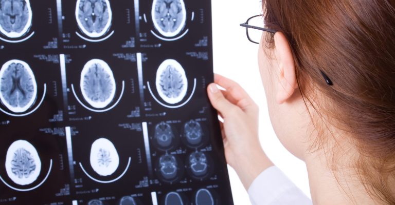 Is Traumatic Brain Injury Permanent
