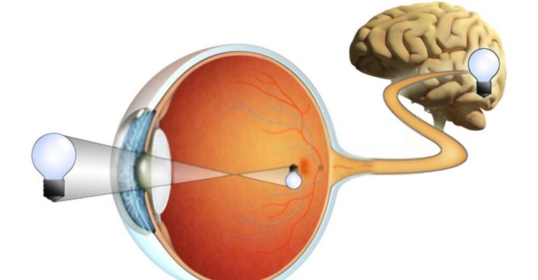 Vision Recovery After a Stroke