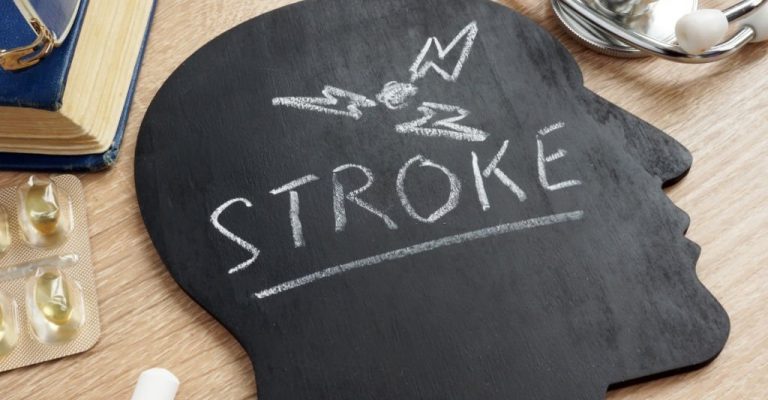 How Long Does It Take for a Person to Recover from a Stroke?